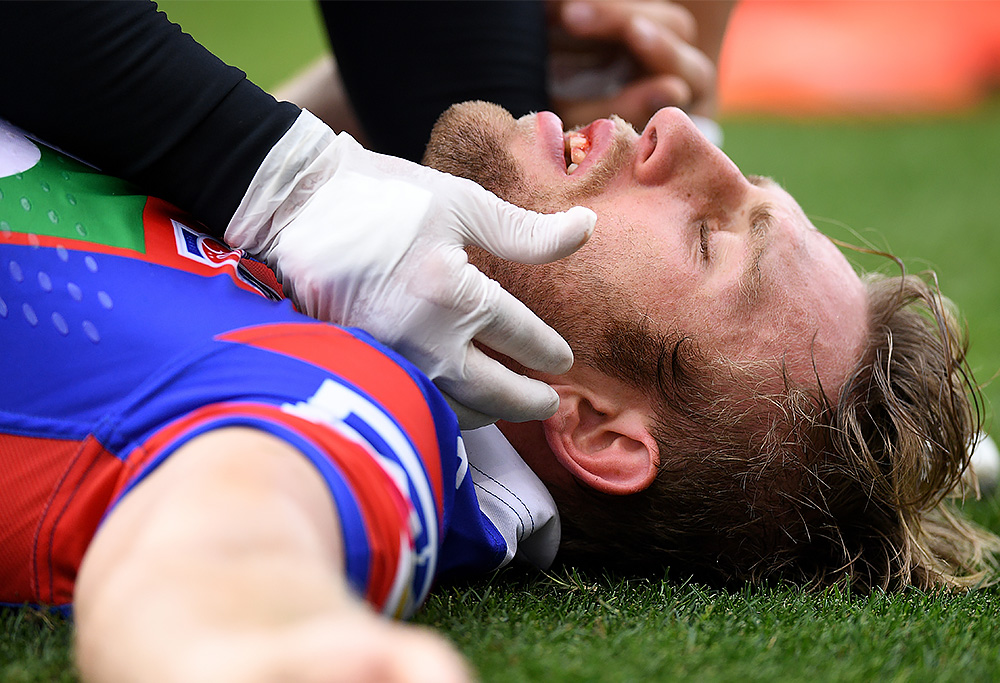 A Beginner S Guide To Concussion In Rugby League