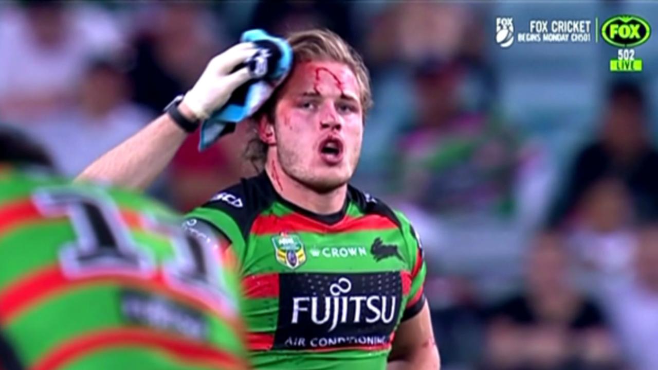 Burgess brothers bring new meaning to the term friendly fire