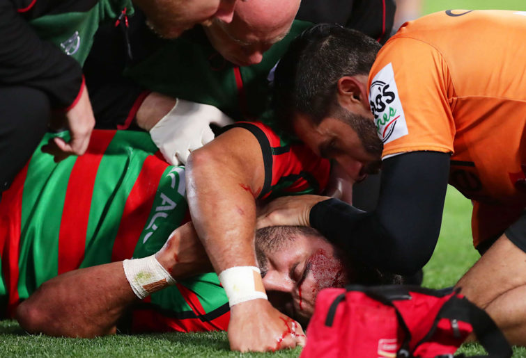 Alex Johnston of the Rabbitohs lies down injured