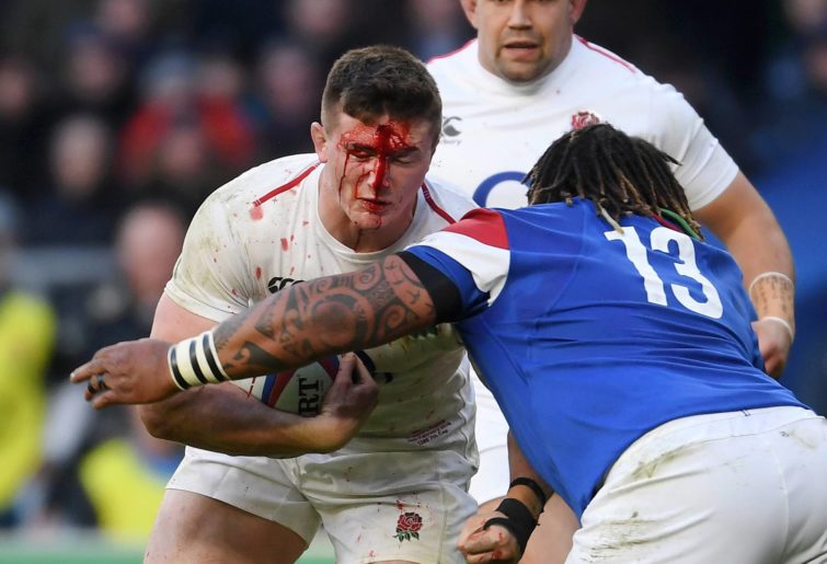: A bloody Tom Curry of England is tackled by Mathieu Bastareaud of France during the Guinness Six Nations match between England and France at Twickenham Stadium on February 10, 2019 in London, England. (Photo by Mike Hewitt/Getty Images)