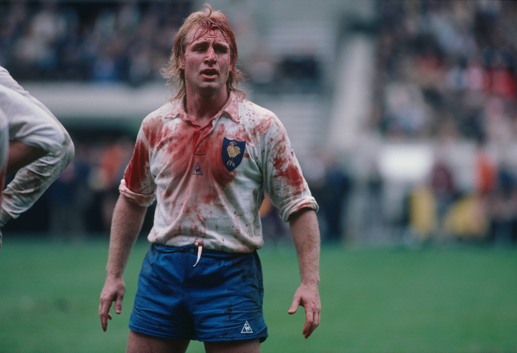 Jean-Pierre Rives, nicknamed "Casque d'Or" (French for Golden helmet) from France, with a bloody face, during a Five Nations Championship match against Wales. France won 16-9. (Photo by Jean-Yves Ruszniewski/TempSport/Corbis/VCG via Getty Images)